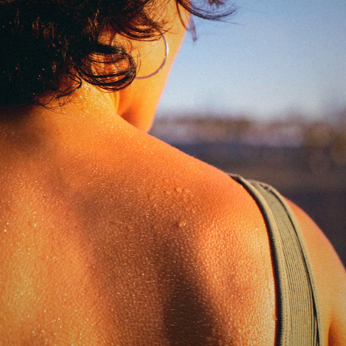Peau marquée par la chaleur et la transpiration